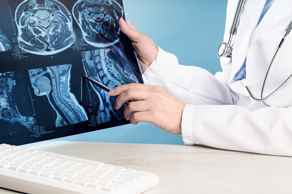 Traumatic-Brain-Injury